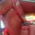  Volvo P1800E Fuel Injected Coupe 