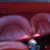 An unrestored original big Healey in Great Condition.